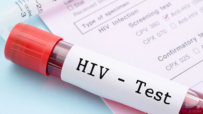 HIVЯӹ⴫