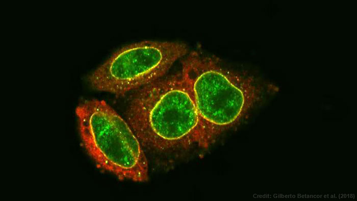 оHIV DNAֹϸ˵ķӻ