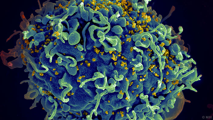 ѧоHIV²