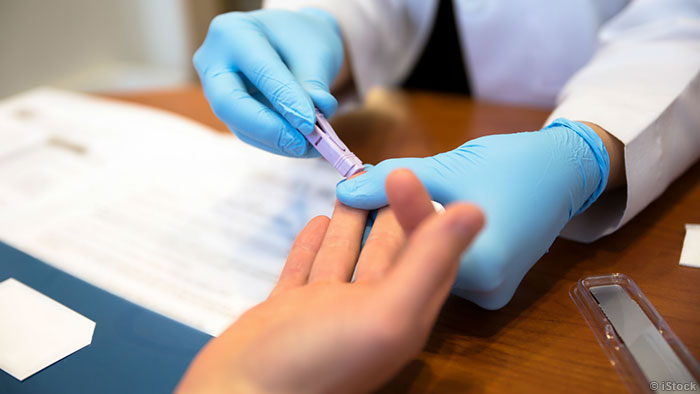 ״δԱзHIV-1ж